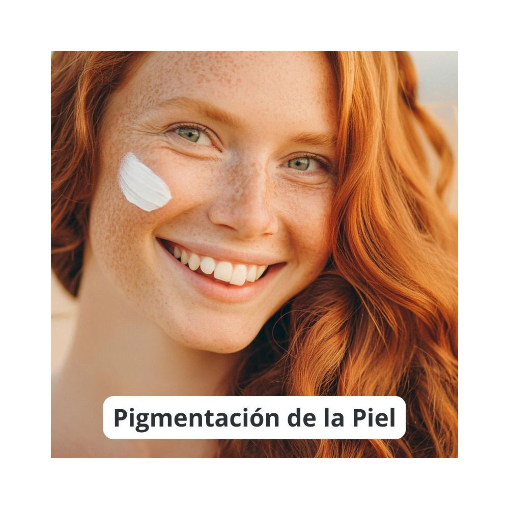 Pigmentación de la Piel: Qué Es, Causas y Cómo Tratarla
